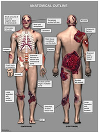 Custom Illustrations